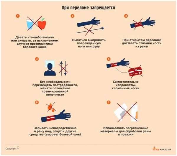 Как оказать 1 помощь при открытом переломе кости. ПМП (первая медицинская помощь) при открытом переломе костей конечности