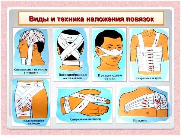 Как забинтовать рану. Правила перевязки различных ран