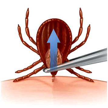 Можно ли самим достать клеща. Как удалить клеща с тела человека в домашних условиях